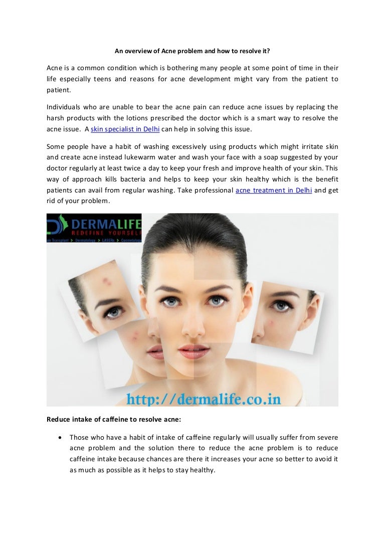 2019 year - An Overview of Acne 2019 year